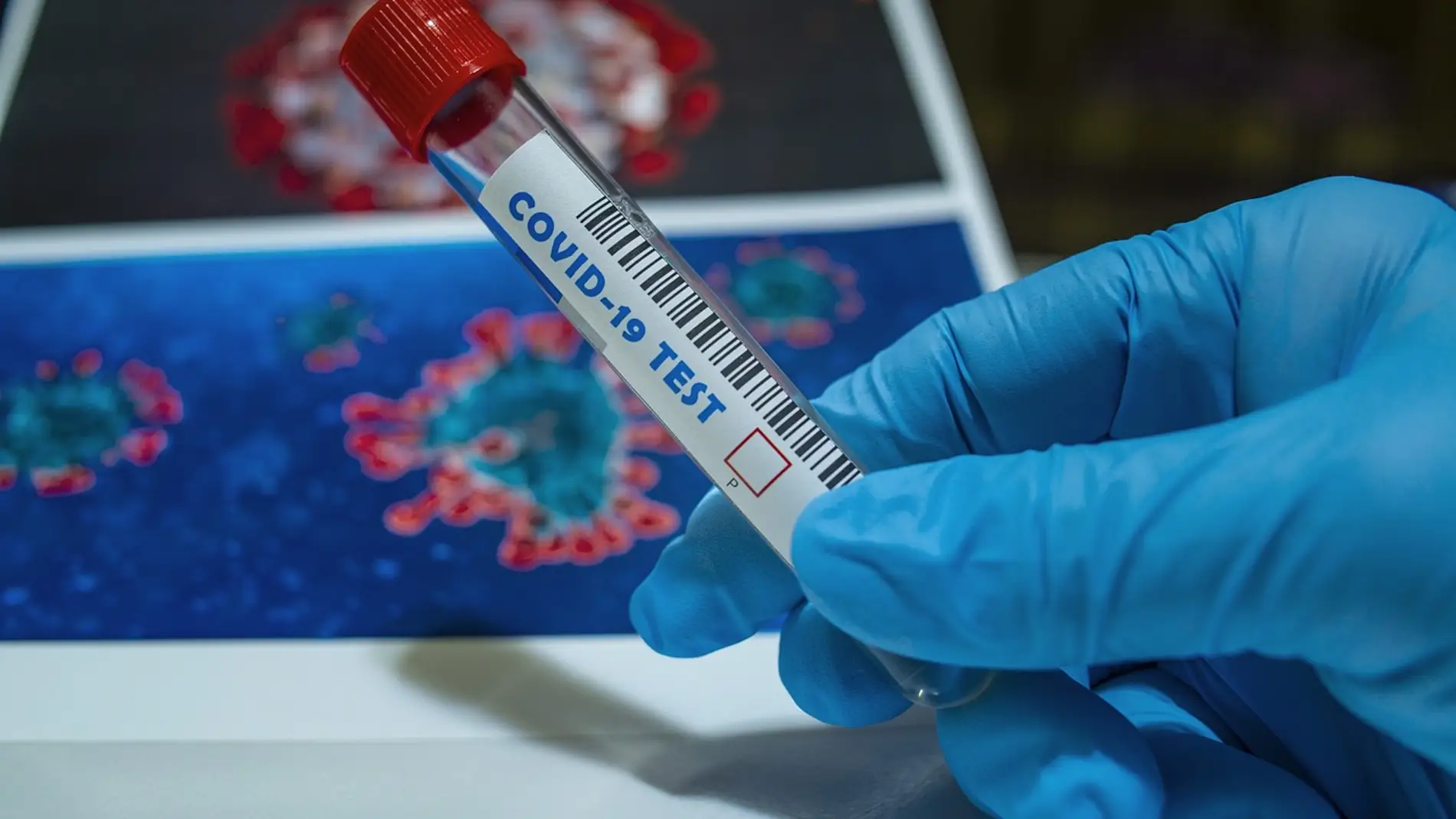 Descubre los síntomas de la nueva variante de COVID-19 que ya se está extendiendo rápidamente por Europa 9 Merca2.es ¿Qué hay de las vacunas? ¿Protegen contra la variante XEC?