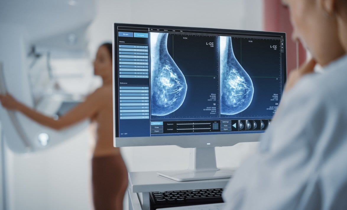 El 70% de las mujeres supervivientes de cáncer de mama ha visto frenada su trayectoria laboral como consecuencia de la enfermedad El 70% de las mujeres supervivientes de cáncer de mama ha visto frenada su trayectoria laboral como consecuencia de la enfermedad
