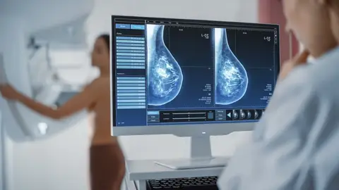 mamografía, cáncer de mama. mamografía, cáncer de mama