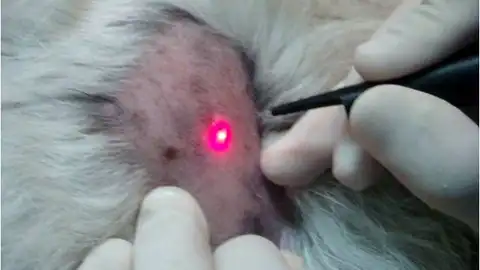 Laserterapia Laserterapia