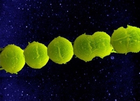 Alerta por el incremento de casos graves causados por la 'bactería carnívora': qué es y cuáles son los síntomas Alerta por el incremento de casos graves causados por la 'bactería carnívora': qué es y cuáles son los síntomas