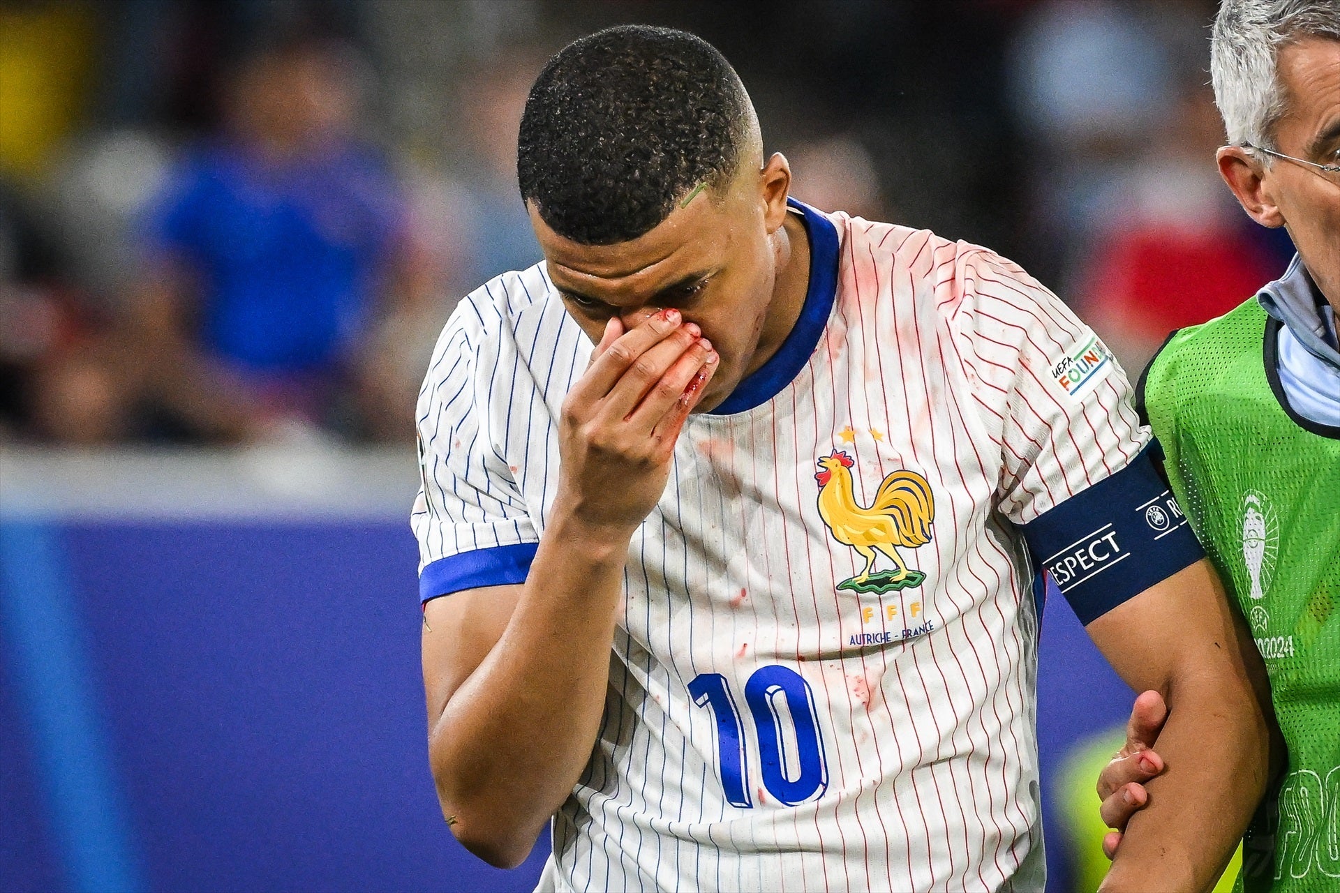 Así es la máscara facial con la que jugará Mbappé en la Eurocopa tras romperse la nariz Así es la máscara facial con la que jugará Mbappé en la Eurocopa tras romperse la nariz