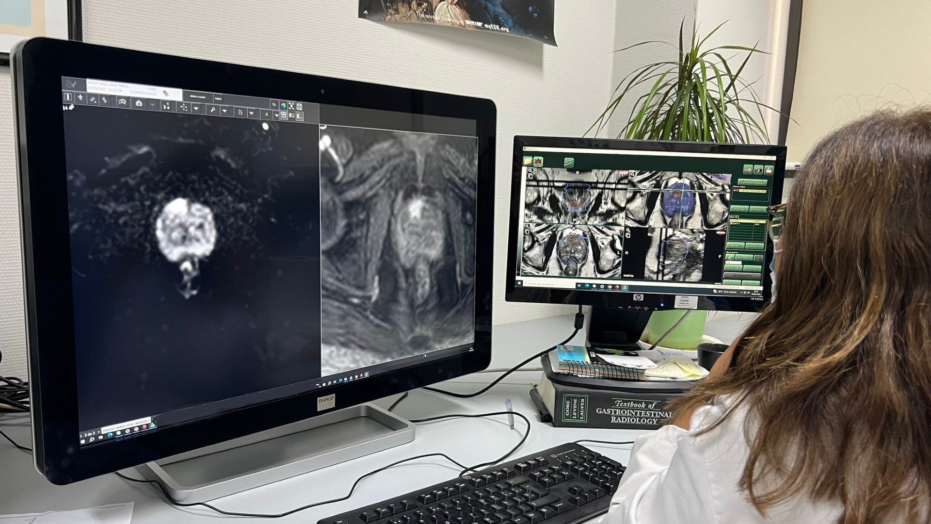 IA en el Hospital de La Ribera para abordar el cáncer de próstata IA en el Hospital de La Ribera para abordar el cáncer de próstata