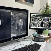 Software para la detección del cáncer de próstata