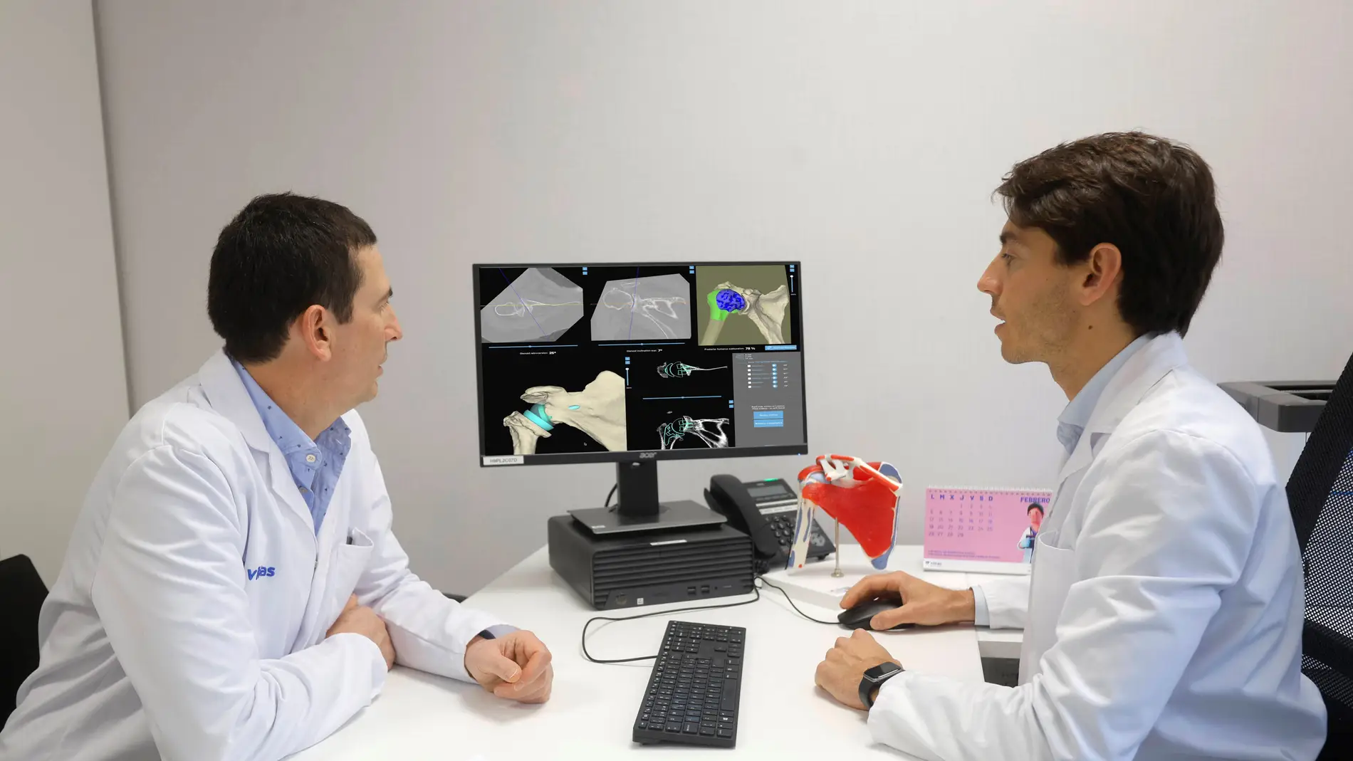 Máxima precisión en cirugía de prótesis hombro con planificación preoperatoria en TAC 3D