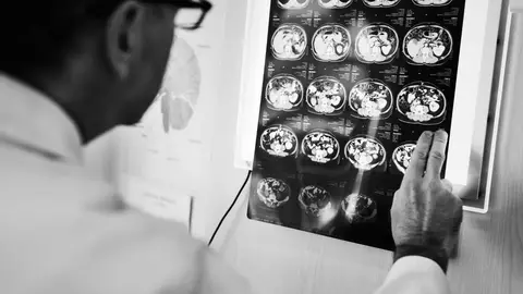 Imagen de recurso. Personal médico revisando una prueba cerebral Imagen de recurso. Personal médico revisando una prueba cerebral