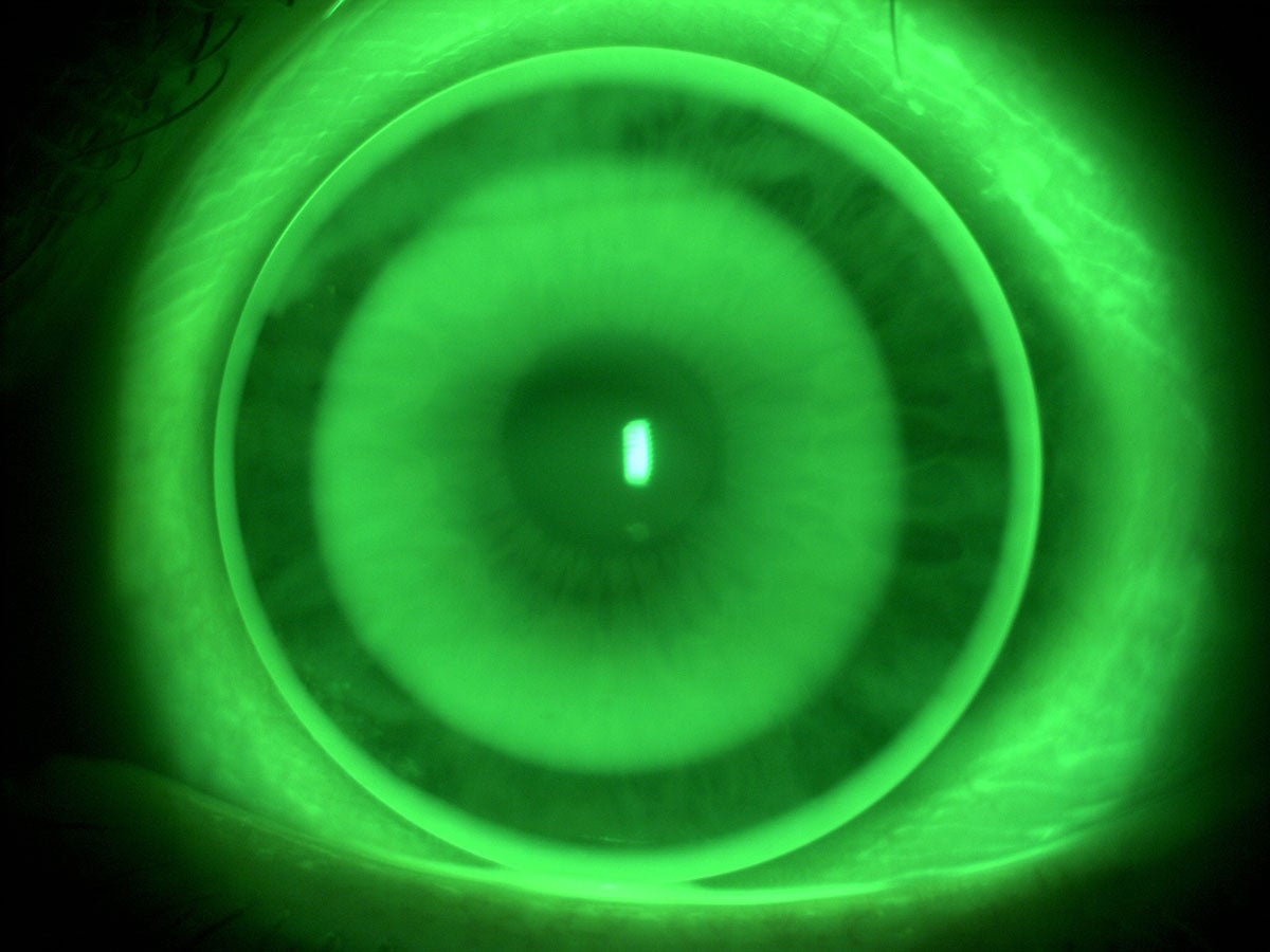 La Universidad de Alicante prueba una lente de contacto para frenar la miopía en niños La Universidad de Alicante prueba una lente de contacto para frenar la miopía en niños