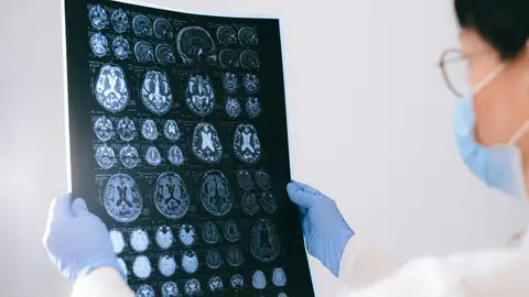 Recreación de una fotografía cerebral Recreación de una fotografía cerebral