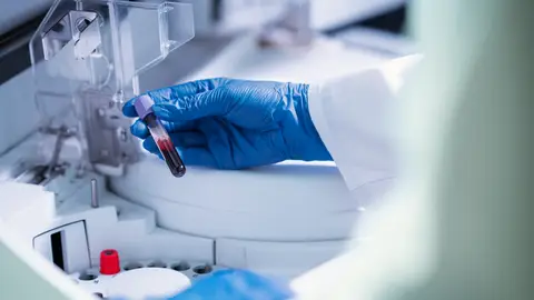 Imagen de recurso de un laboratorio en el que un profesional sostiene una muestra de sangre Imagen de recurso de un laboratorio en el que un profesional sostiene una muestra de sangre