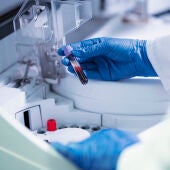 Imagen de recurso de un laboratorio en el que un profesional sostiene una muestra de sangre 