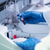 Imagen de recurso de un laboratorio en el que un profesional sostiene una muestra de sangre Imagen de recurso de un laboratorio en el que un profesional sostiene una muestra de sangre