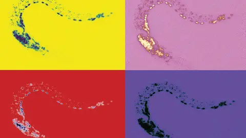 Gusano transgénico generado mediante edición genética con la tecnología CRISPR-Cas9. Gusano transgénico generado mediante edición genética con la tecnología CRISPR-Cas9.