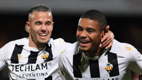 La lesión de Douglas "amarga " la previa ante el Burgos La lesión de Douglas "amarga " la previa ante el Burgos