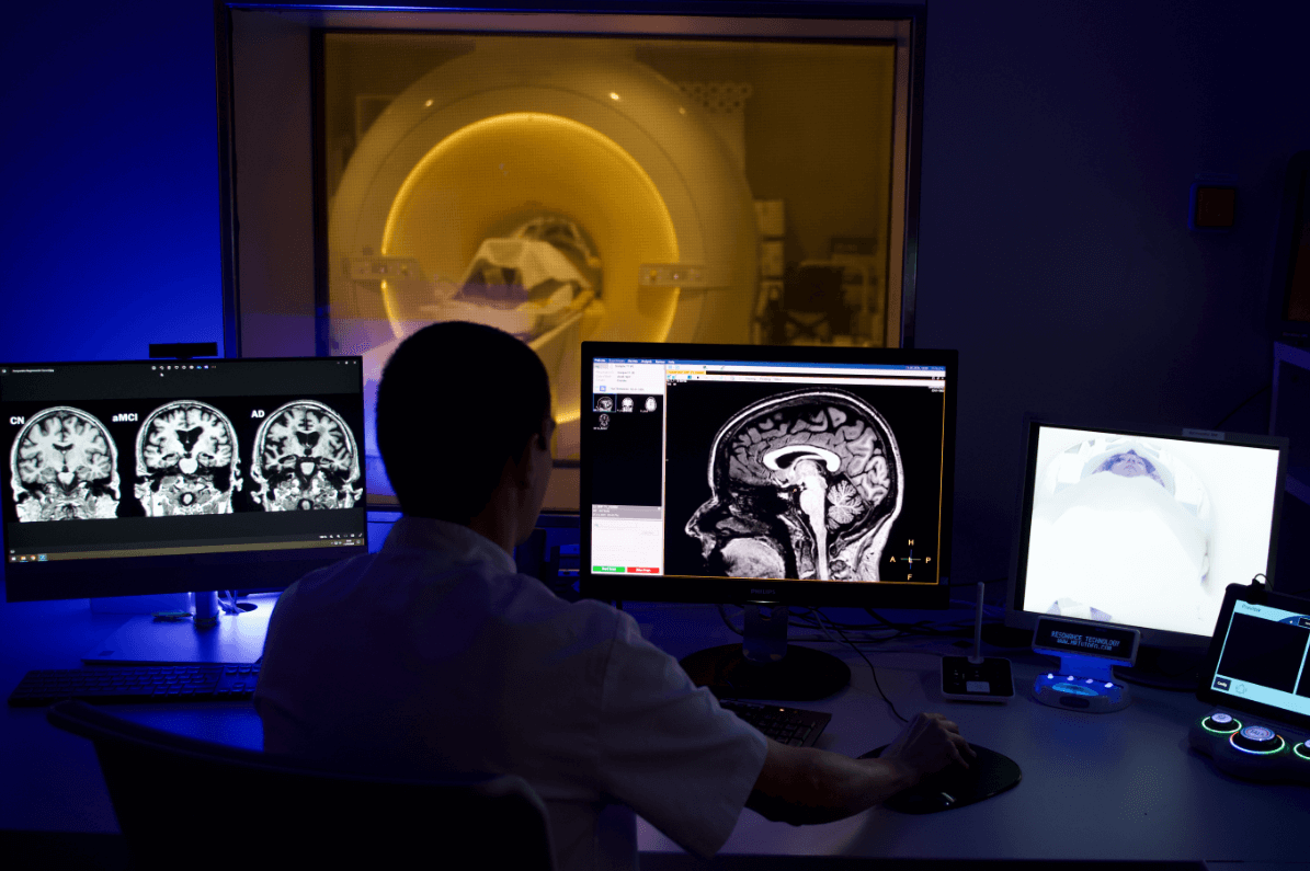 Un 13% dels casos d'Alzheimer arreu del món es poden atribuir a la inactivitat física Un 13% dels casos d'Alzheimer arreu del món es poden atribuir a la inactivitat física