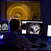 Investigación Alzheimer Investigación Alzheimer