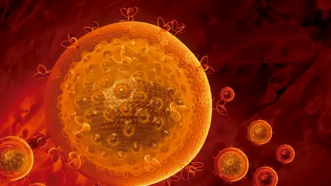 Virus del Sida Virus del Sida