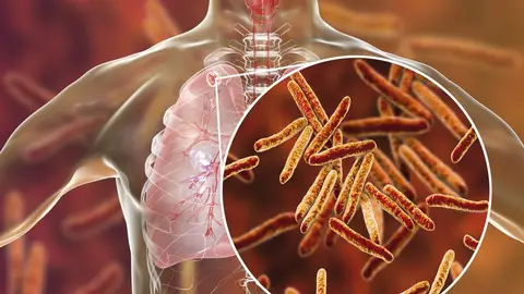 Recreación de la bacteria Mycobacterium tuberculosis. Recreación de la bacteria Mycobacterium tuberculosis.