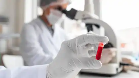 La colonoscopia y la sangre en heces son equivalentes para detectar cancer de colon La colonoscopia y la sangre en heces son equivalentes para detectar cancer de colon