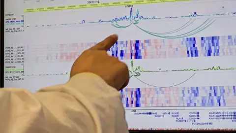 Una investigación del Hospital público 12 de Octubre descubre por qué aumenta el riesgo de padecer un grupo de enfermedades hematológicas crónicas Una investigación del Hospital público 12 de Octubre descubre por qué aumenta el riesgo de padecer un grupo de enfermedades hematológicas crónicas