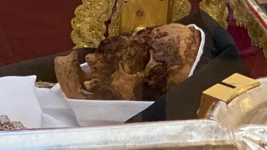 Rostro de Santa Teresa Rostro de Santa Teresa
