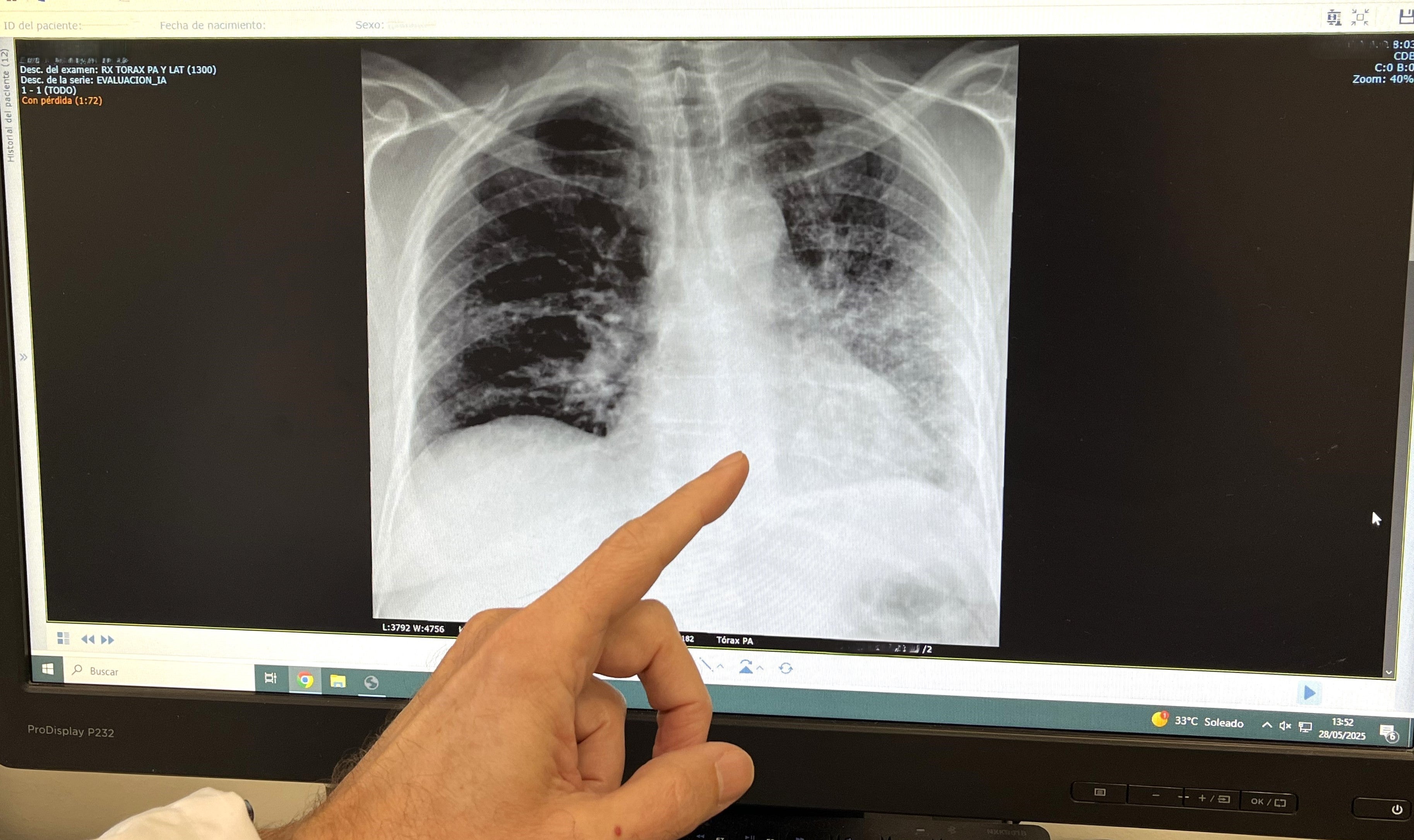 Expertos alertan de que el tabaquismo sigue siendo la mayor amenaza para la salud, liderando el ranking de muertes evitables Expertos alertan de que el tabaquismo sigue siendo la mayor amenaza para la salud, liderando el ranking de muertes evitables