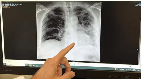 Expertos alertan de que el tabaquismo sigue siendo la mayor amenaza para la salud, liderando el ranking de muertes evitables Expertos alertan de que el tabaquismo sigue siendo la mayor amenaza para la salud, liderando el ranking de muertes evitables