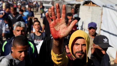 "Un hombre palestino muestra manchas de sangre en su palma después de haber cargado a heridos entre las personas que buscaban ayuda suministrada por la Fundación Humanitaria de Gaza "Un hombre palestino muestra manchas de sangre en su palma después de haber cargado a heridos entre las personas que buscaban ayuda suministrada por la Fundación Humanitaria de Gaza