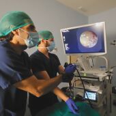 La ecobroncoscopia (EBUS) mejora el diagnóstico y la estadificación del cáncer de pulmón