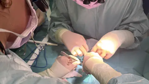 Cirujanos cardiacos pediátricos del Hospital público 12 de Octubre corrigen en Burgos una malformación en el corazón de un bebé prematuro Cirujanos cardiacos pediátricos del Hospital público 12 de Octubre corrigen en Burgos una malformación en el corazón de un bebé prematuro