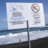 Imagen de archivo del cierre de Playa Jardín en Puerto de la Cruz por la presencia de bacterias fecales en el agua