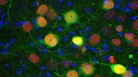 Imagen de microscopía confocal que muestra células de la amígdala basolateral. Imagen de microscopía confocal que muestra células de la amígdala basolateral.