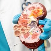 Una técnica mínimamente invasiva logra controlar la hipertensión resistente y reducir el uso de fármacos