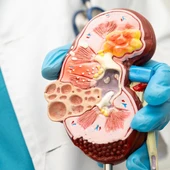 Una técnica mínimamente invasiva logra controlar la hipertensión resistente y reducir el uso de fármacos Una técnica mínimamente invasiva logra controlar la hipertensión resistente y reducir el uso de fármacos