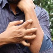 Los especialistas de Vithas en Andalucía repasan las claves para prevenir y actuar ante las principales alergías