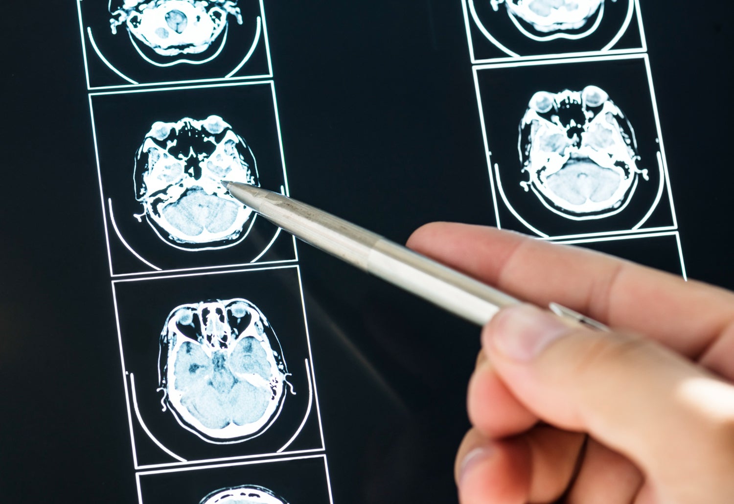El rasgo del habla que presagia el deterioro cognitivo, según los científicos El rasgo del habla que presagia el deterioro cognitivo, según los científicos