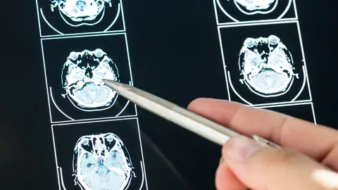 Imagen de recurso de una prueba cerebral Imagen de recurso de una prueba cerebral