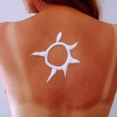 Cómo saber si el sol está dañando tu piel: señales que no debes ignorar, según los expertos Cómo saber si el sol está dañando tu piel: señales que no debes ignorar, según los expertos