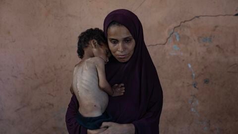 El niño palestino Yazan Abu Foul, que sufre de malnutrición, junto a su madre Naima, este sábado en el campo de refugiados Al Shati, al este de Gaza. El niño palestino Yazan Abu Foul, que sufre de malnutrición, junto a su madre Naima, este sábado en el campo de refugiados Al Shati, al este de Gaza.