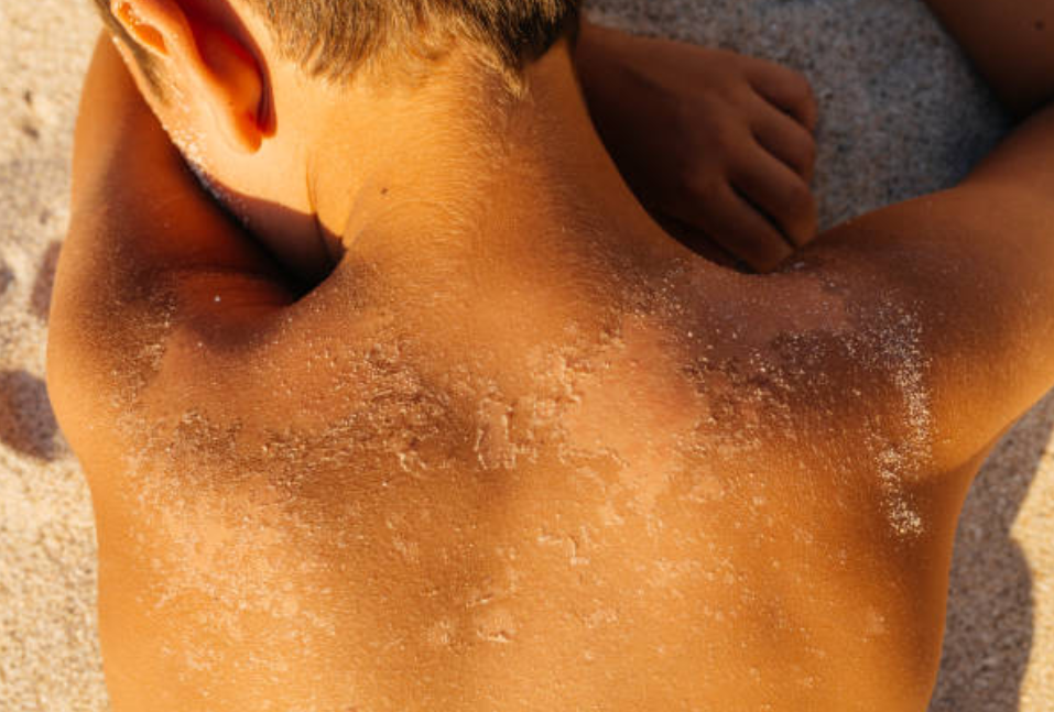 Más de uno Ceuta 5/8/25 Más de uno Ceuta 5/8/25