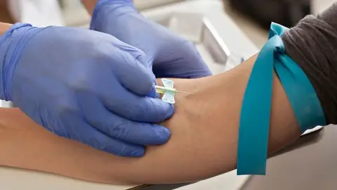 El Banco de Sangre de Extremadura programa el calendario de donaciones de agosto para disponer de reservas de sangre El Banco de Sangre de Extremadura programa el calendario de donaciones de agosto para disponer de reservas de sangre