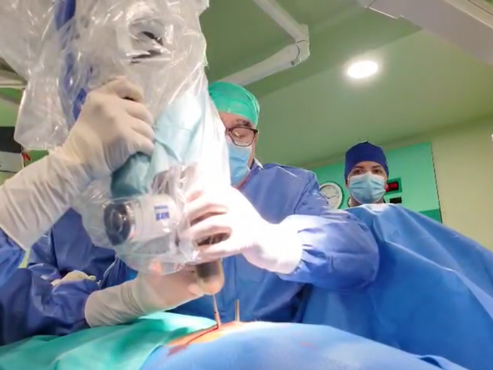 El Hospital Clínico de Zaragoza realiza una técnica pionera de radioterapia en España El Hospital Clínico de Zaragoza realiza una técnica pionera de radioterapia en España