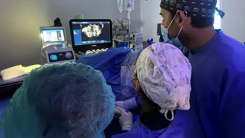 El Hospital Universitario del Vinalopó realiza con éxito la primera sesión de cirugía con radiofrecuencia para tratar miomas uterinos El Hospital Universitario del Vinalopó realiza con éxito la primera sesión de cirugía con radiofrecuencia para tratar miomas uterinos