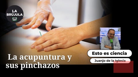 Esto es ciencia: La acupuntura y sus pinchazos