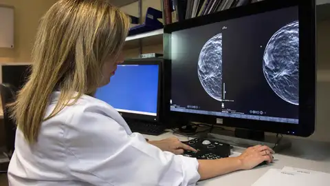 Polémica en Andalucía por los retrasos en el diagnóstico del cáncer de mama: "No han estado llamando a las mujeres, esto es muy fuerte"