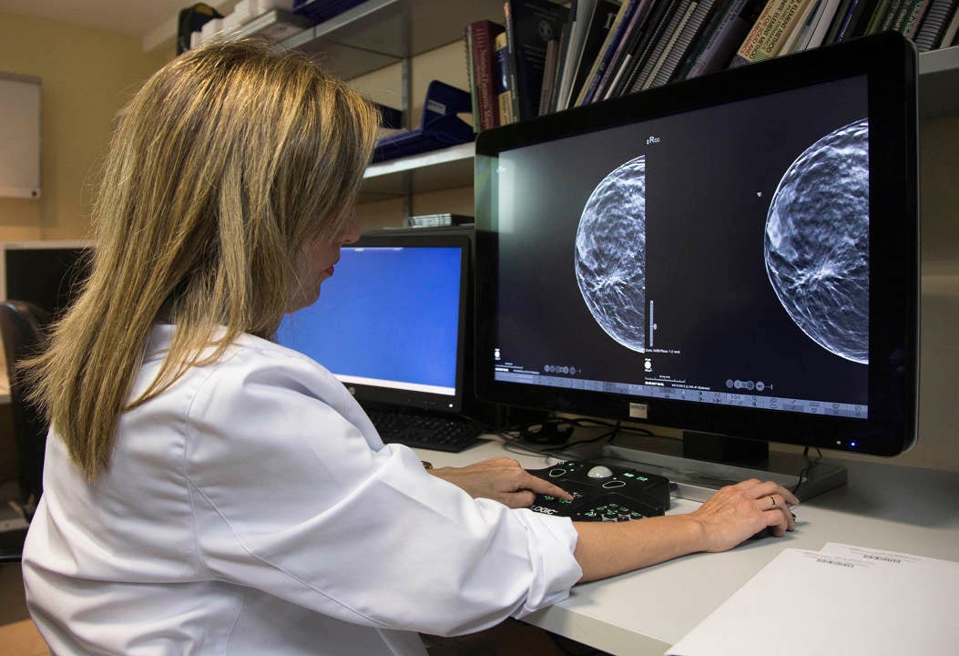 Andalucía eleva a 2.317 las mujeres afectadas por el cribado del cáncer de mama y 1.778 se han hecho ya mamografías Andalucía eleva a 2.317 las mujeres afectadas por el cribado del cáncer de mama y 1.778 se han hecho ya mamografías