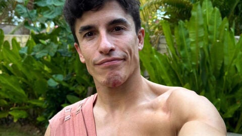 Susto para el campe&oacute;n