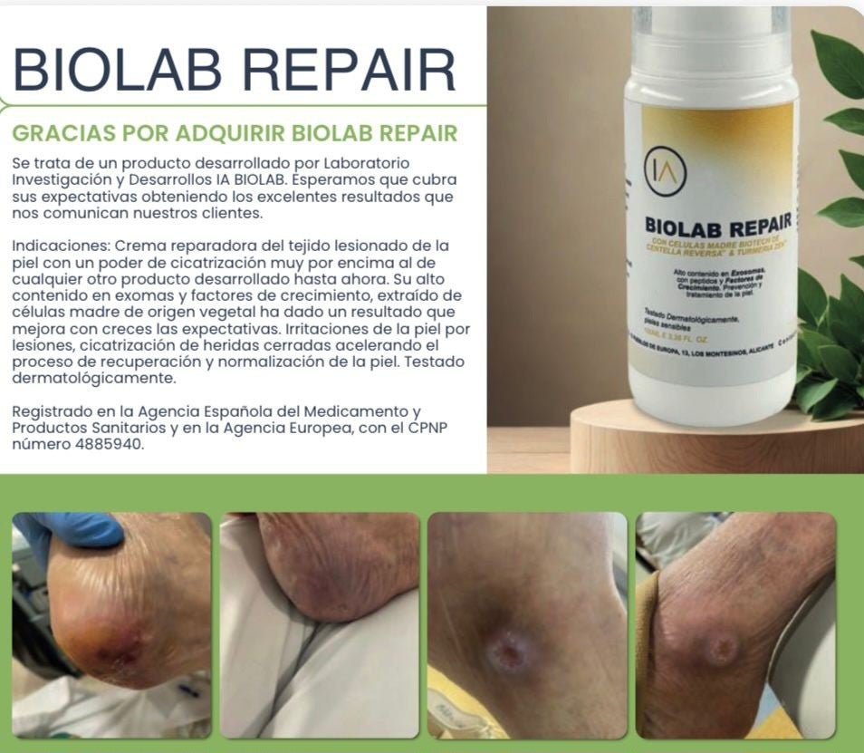 Laboratorio IA Biolab presenta un importante avance en el tratamiento de úlceras de decúbito, conocidas como llagas o escaras Laboratorio IA Biolab presenta un importante avance en el tratamiento de úlceras de decúbito, conocidas como llagas o escaras