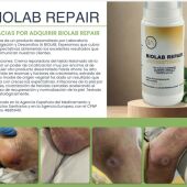 Laboratorio IA Biolab ofrece un importante avance en el tratamiento de úlceras de decúbito, conocidas como llagas o escaras