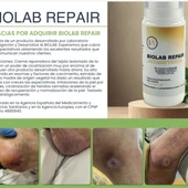 Laboratorio IA Biolab ofrece un importante avance en el tratamiento de úlceras de decúbito, conocidas como llagas o escaras Laboratorio IA Biolab ofrece un importante avance en el tratamiento de úlceras de decúbito, conocidas como llagas o escaras