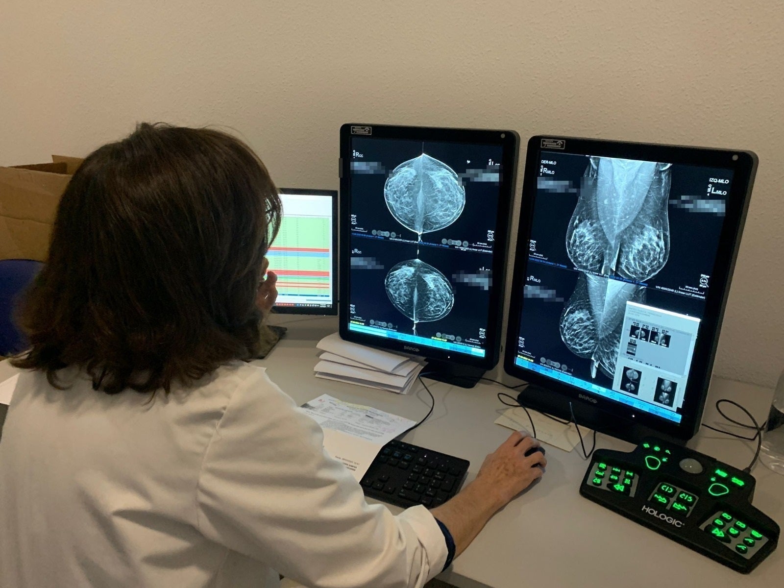 Un estudio refuerza un fármaco contra el cáncer de mama metastásico que actúa como un caballo de Troya Un estudio refuerza un fármaco contra el cáncer de mama metastásico que actúa como un caballo de Troya